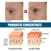 Probiotics Concentrated Anti-wrinkle Serum Hydrating And Firming