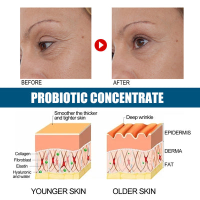 Probiotics Concentrated Anti-wrinkle Serum Hydrating And Firming