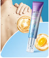 Bedsore Cream Body Moisturizing Cream 20g